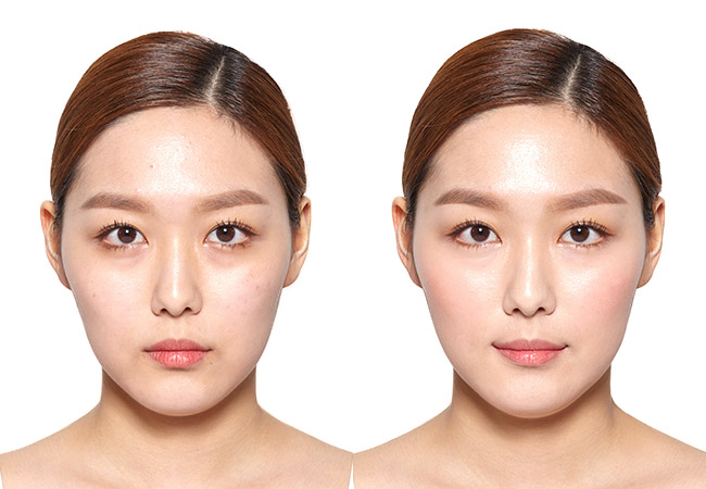 beforeafter